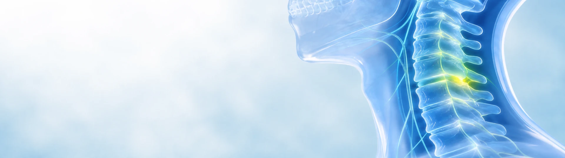 Cervical Spine Treatment 