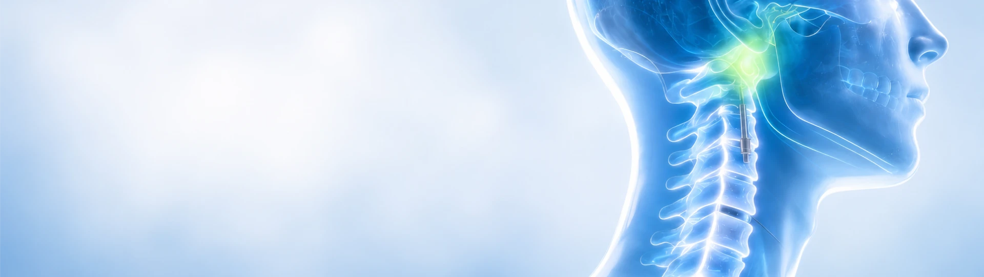 Craniovertebral Junction Surgery