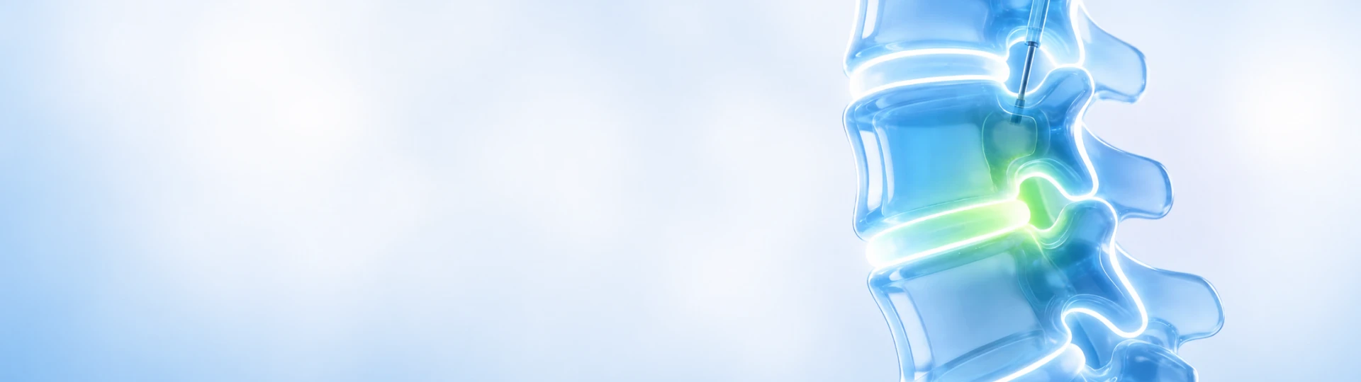 Kyphoplasty & Vertebroplasty 