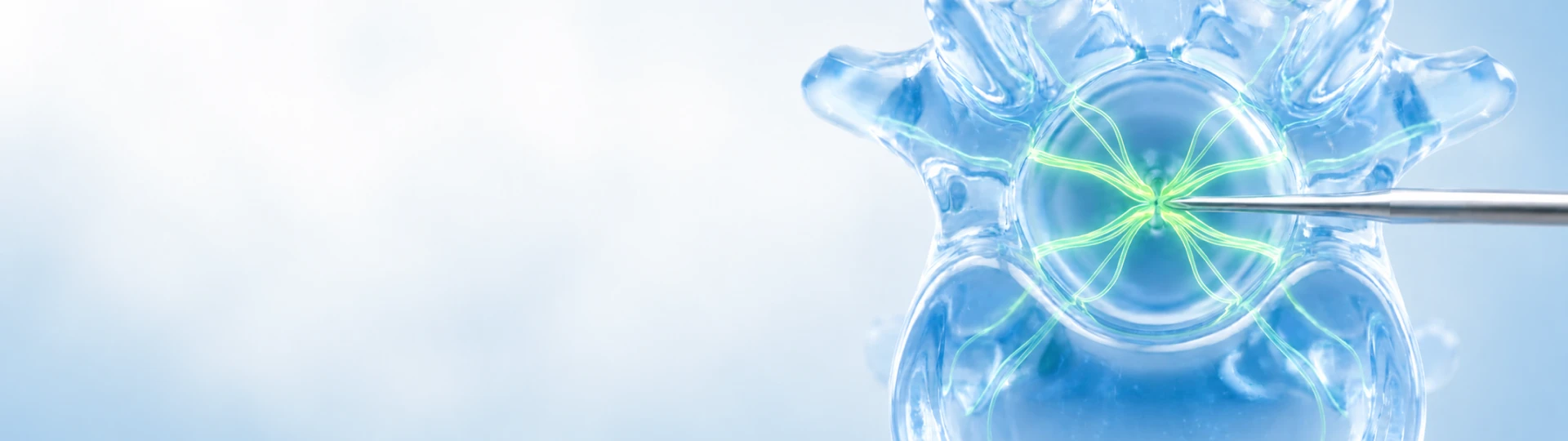 Spinal Stenosis Management